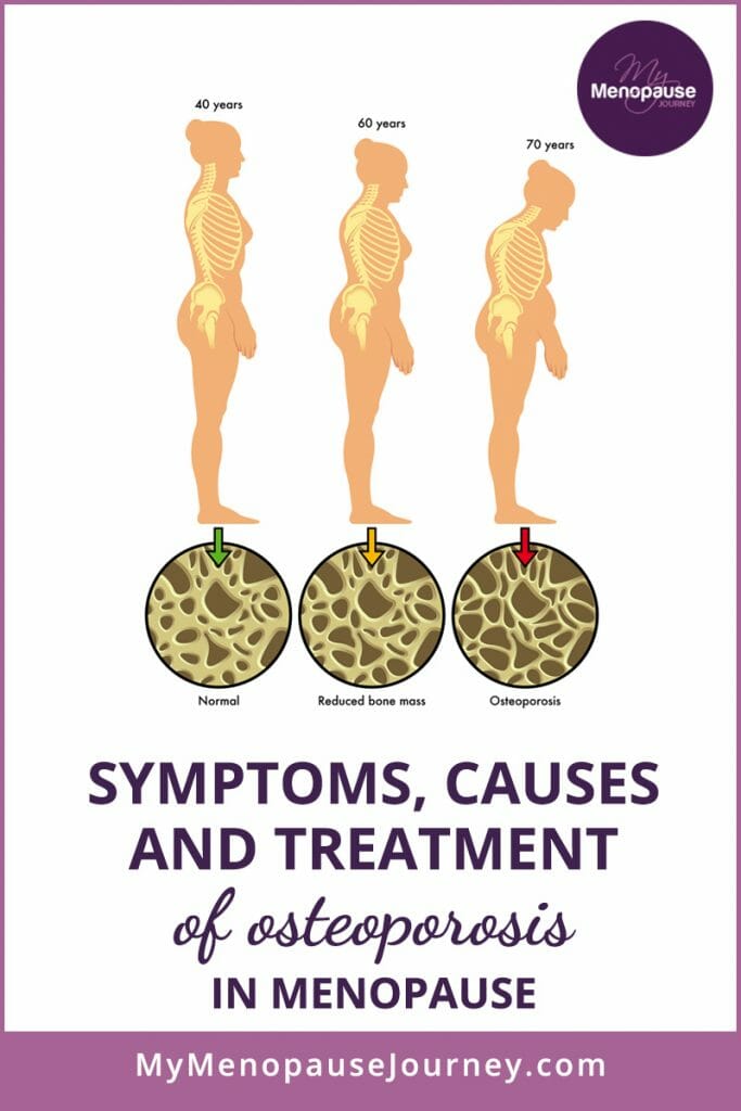 Symptoms, Causes and Treatment of Osteoporosis in Menopause