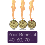 Posture changes and bone density loss from age 40 to 70 &mdash; osteoporosis and menopause progression