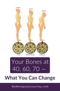 Posture changes and bone density loss from age 40 to 70 &mdash; osteoporosis and menopause progression